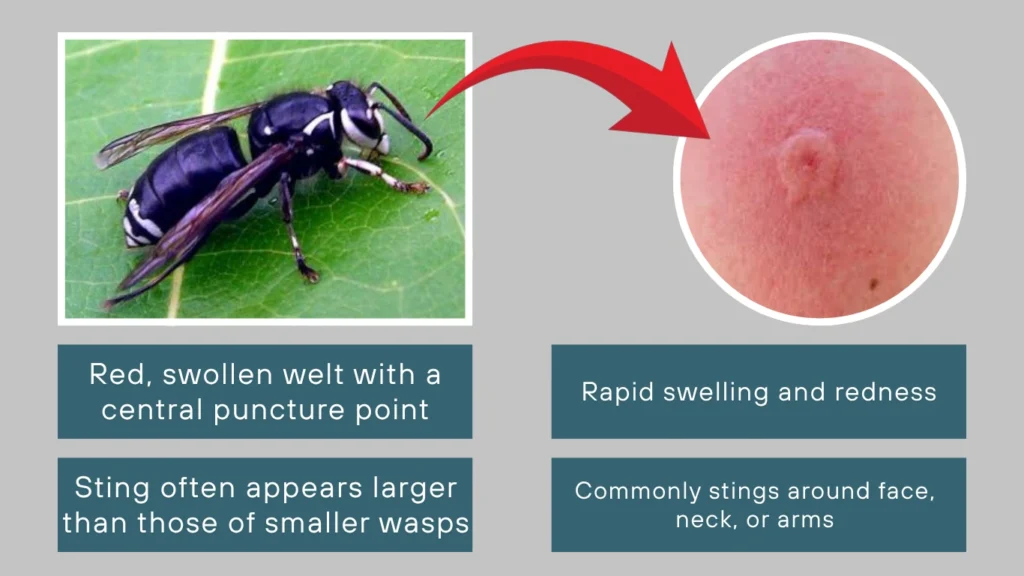 Bald-Faced Hornet Sting