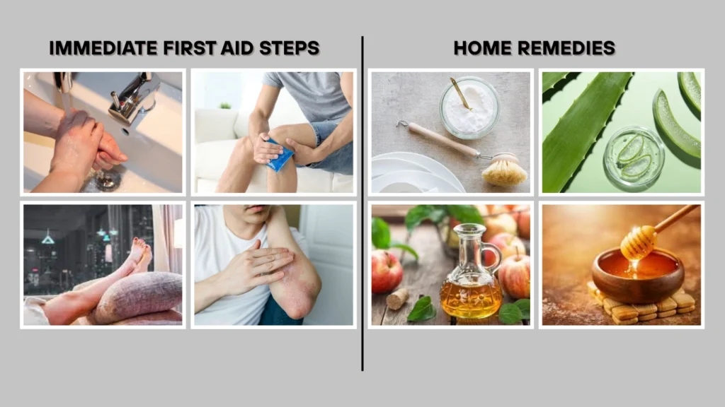Treatment for Wasp Stings