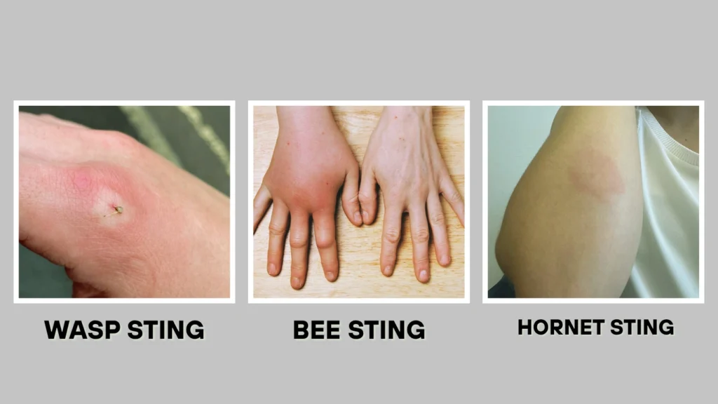 Wasp Sting vs. Other Insect Stings