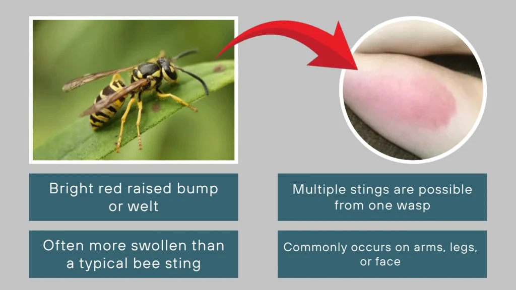 Yellow Jacket Sting