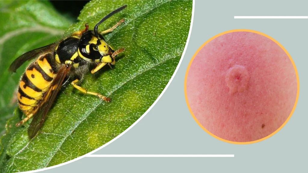 German Wasp Sting