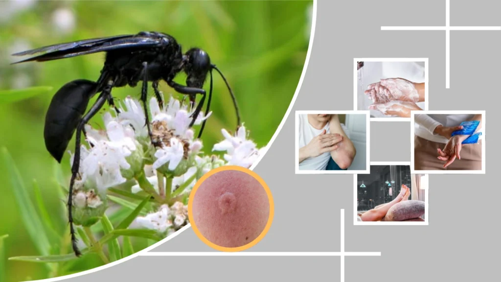 How to Treat a Black Wasp Sting at Home