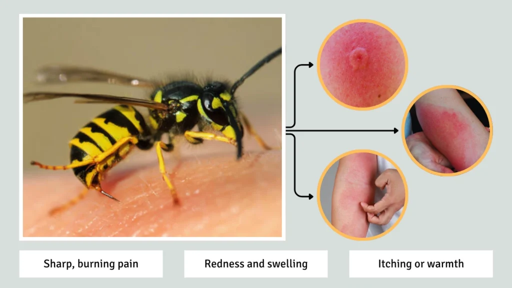 Recognize the Symptoms of a Wasp Sting