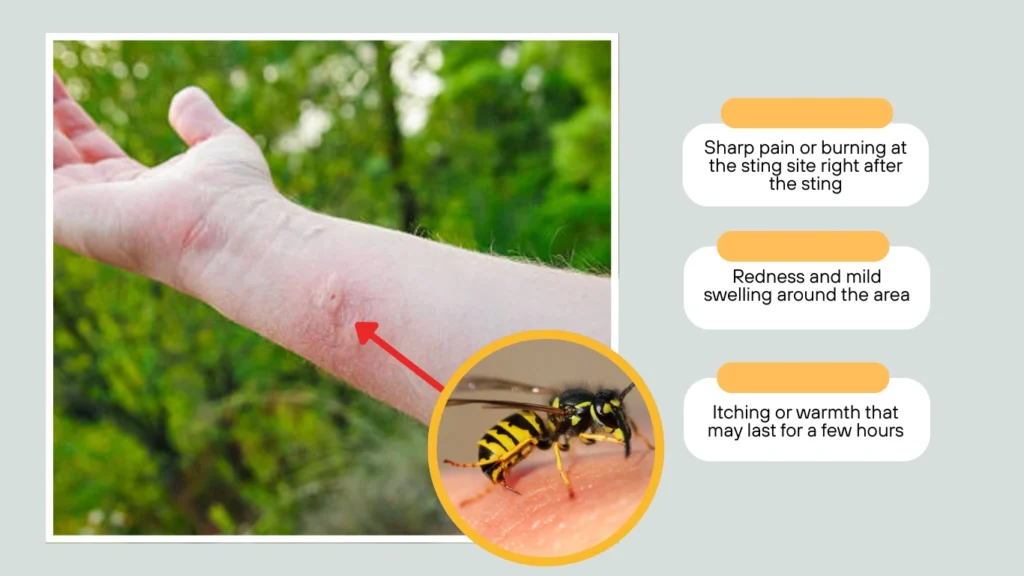What’s a Normal Reaction to a Wasp Sting