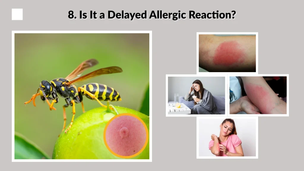 8. Is It a Delayed Allergic Reaction