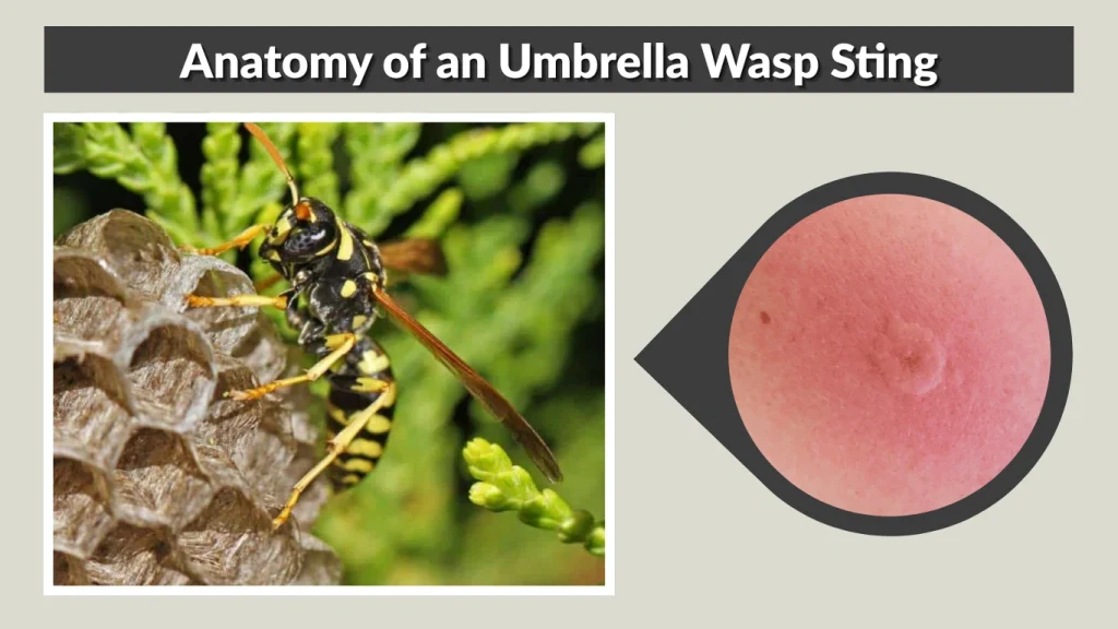Anatomy of an Umbrella Wasp Sting