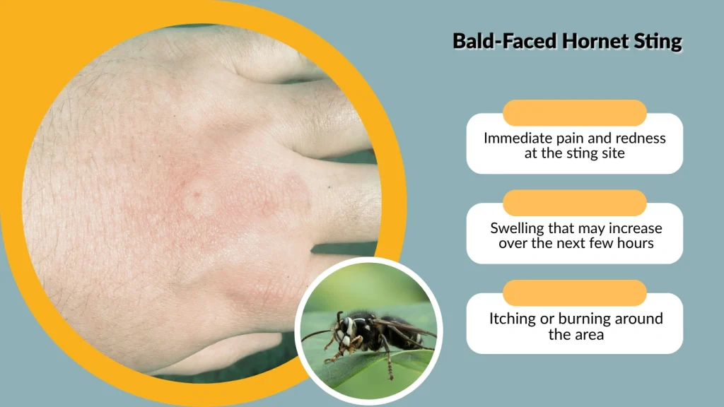 Bald-Faced Hornet Sting What Happens When You're Stung