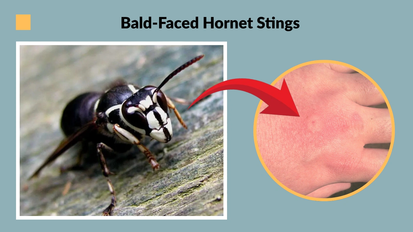 Bald-Faced Hornet Stings Symptoms, Treatment, Aggression & Dangerous