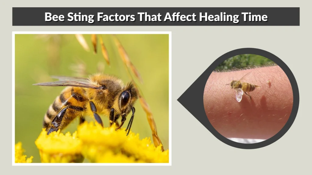 Bee Sting Factors That Affect Healing Time