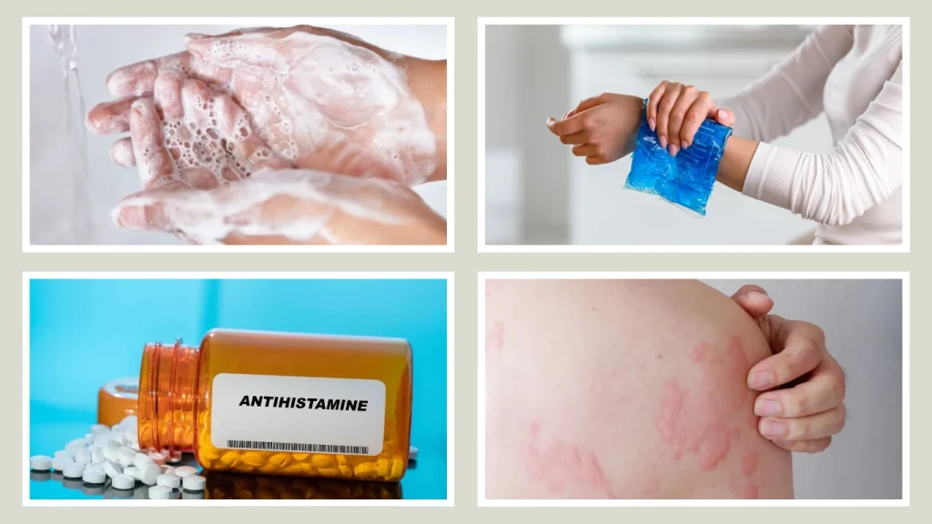 Black Jacket Wasp Sting Treatment