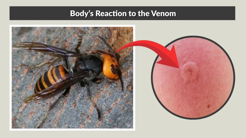 Body’s Reaction to the Venom
