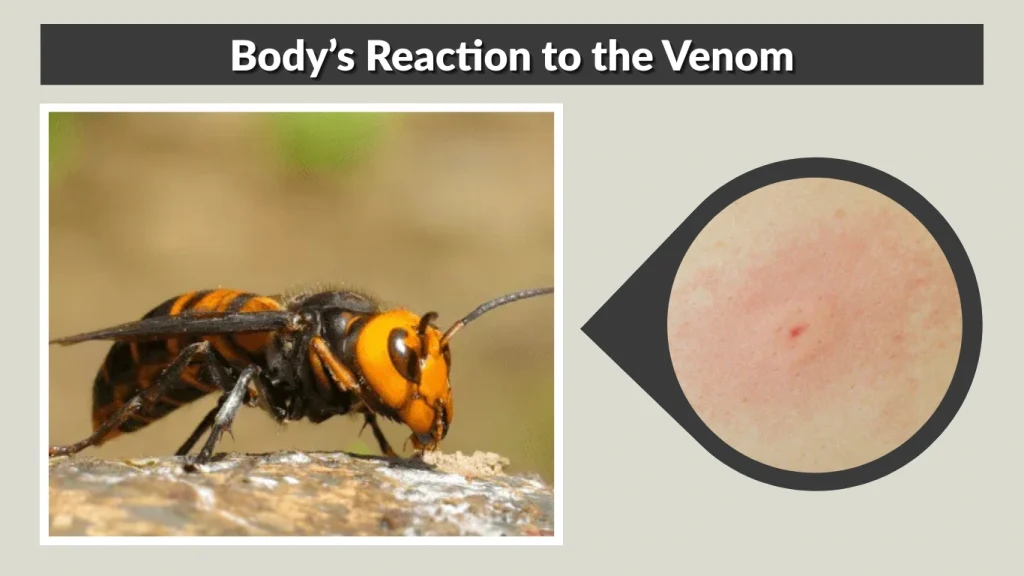 Body’s Reaction to the Venom