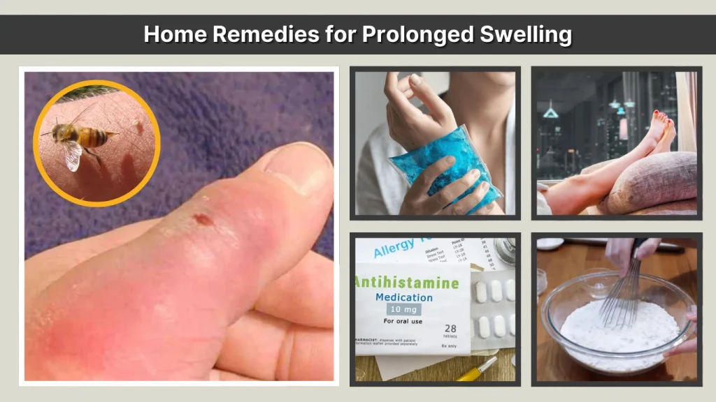 Home Remedies for Prolonged Swelling