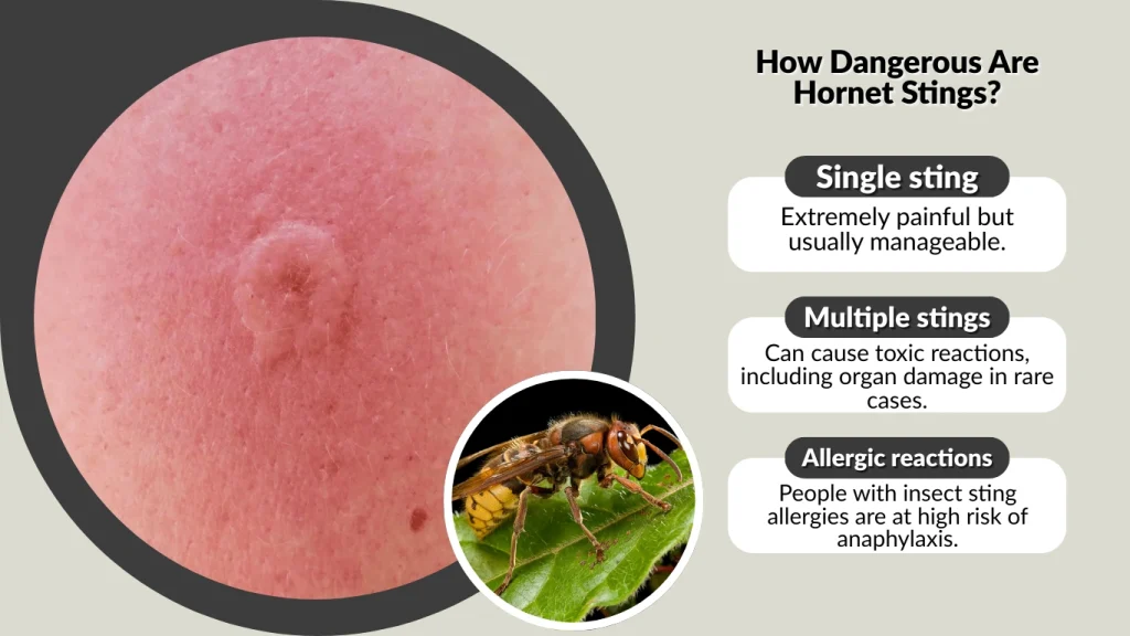 How Dangerous Are Hornet Stings