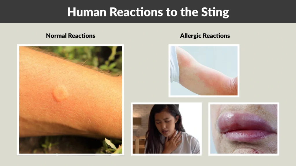 Human Reactions to the Sting