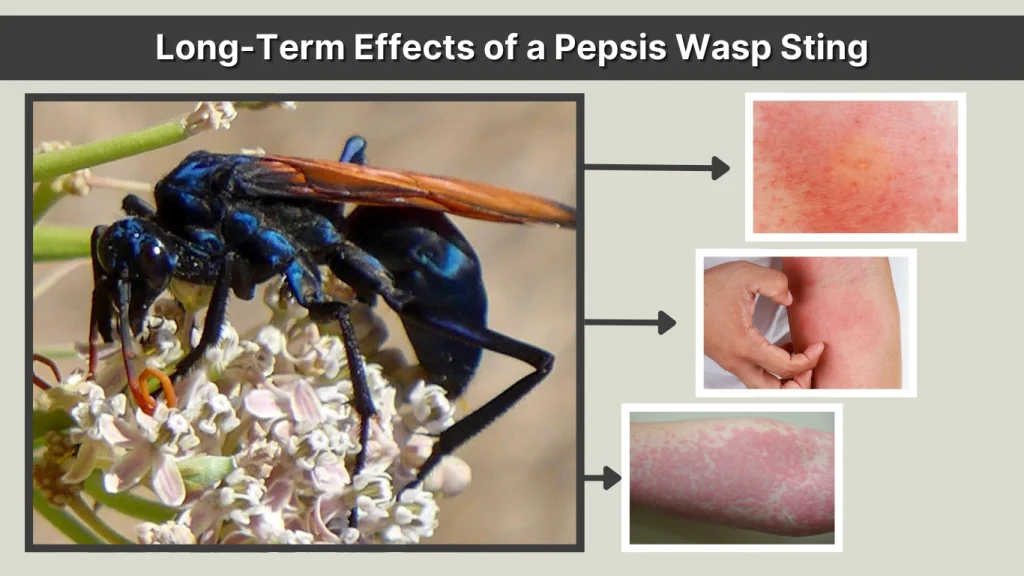 Long-Term Effects of a Pepsis Wasp Sting