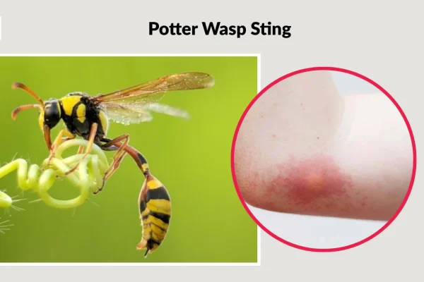Potter Wasps - Wasp World