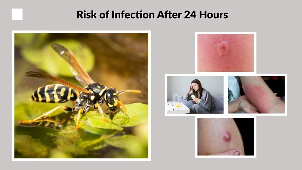 Risk of Infection After 24 Hours