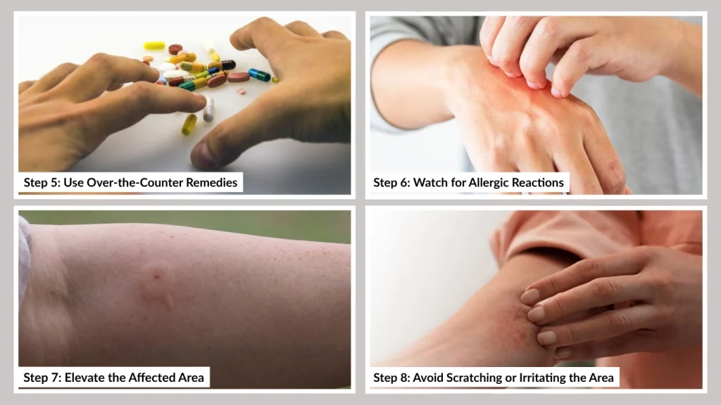 Step 6 Watch for Allergic Reactions