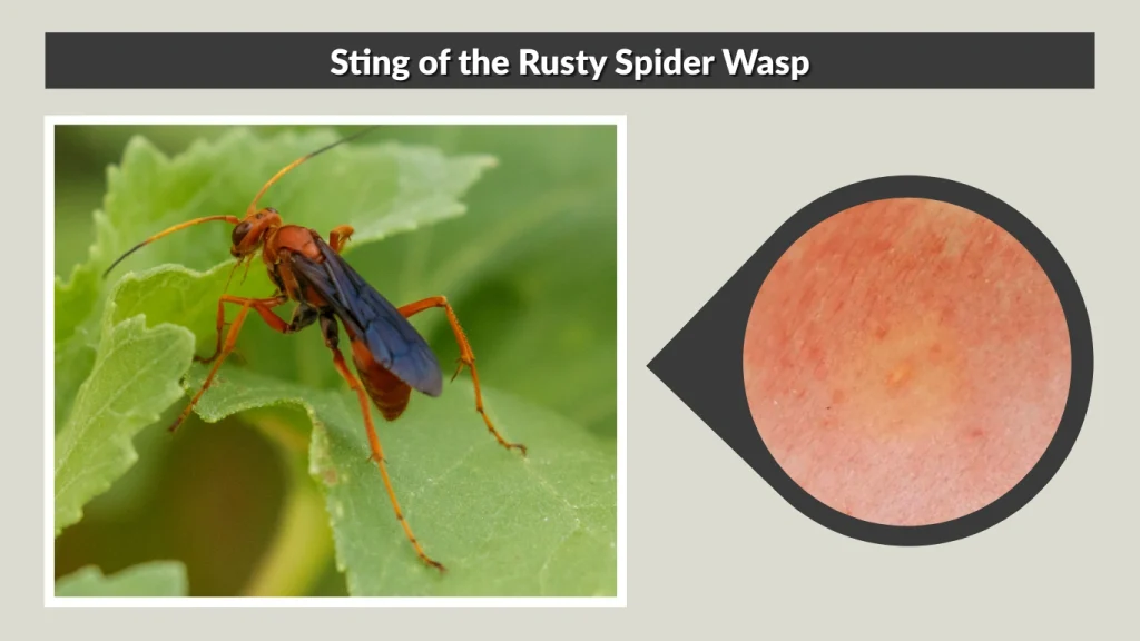 Sting of the Rusty Spider Wasp