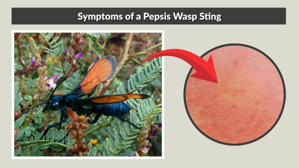 Symptoms of a Pepsis Wasp Sting
