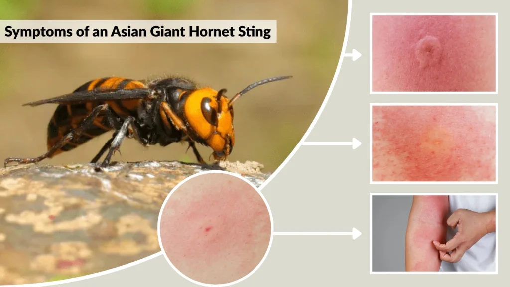 Asian Giant Hornet Sting Symptoms Reaction And Treatment