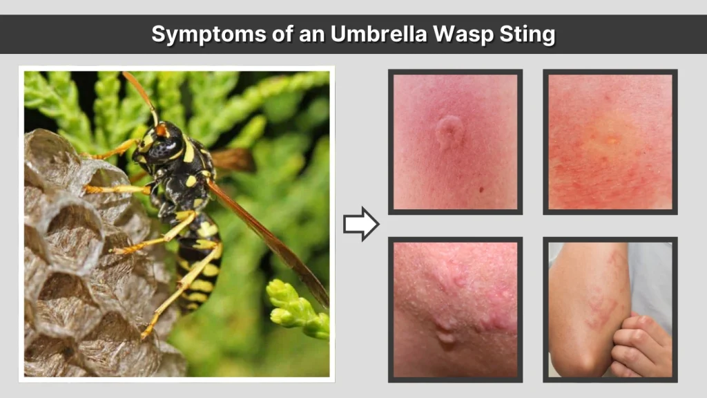 Symptoms of an Umbrella Wasp Sting