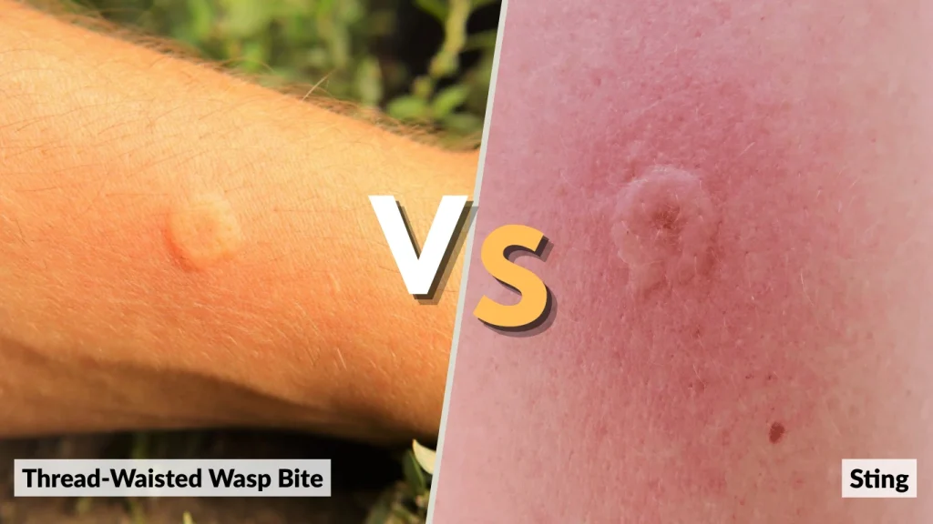 Thread-Waisted Wasp Bite vs. Sting