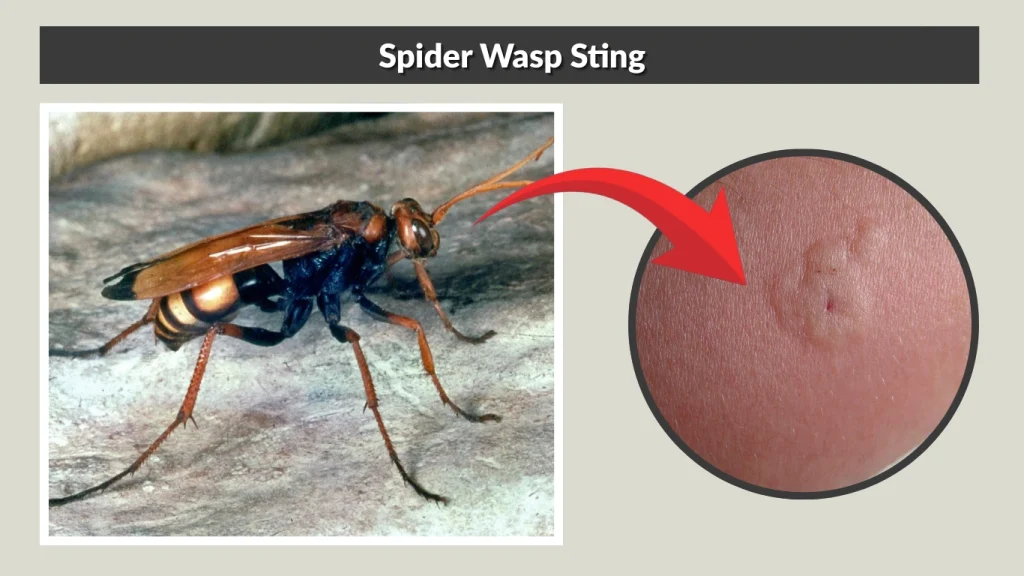 Spider Wasp Sting