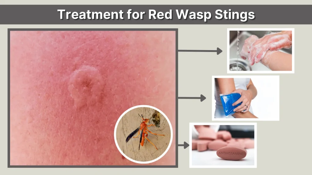 Treatment for Red Wasp Stings