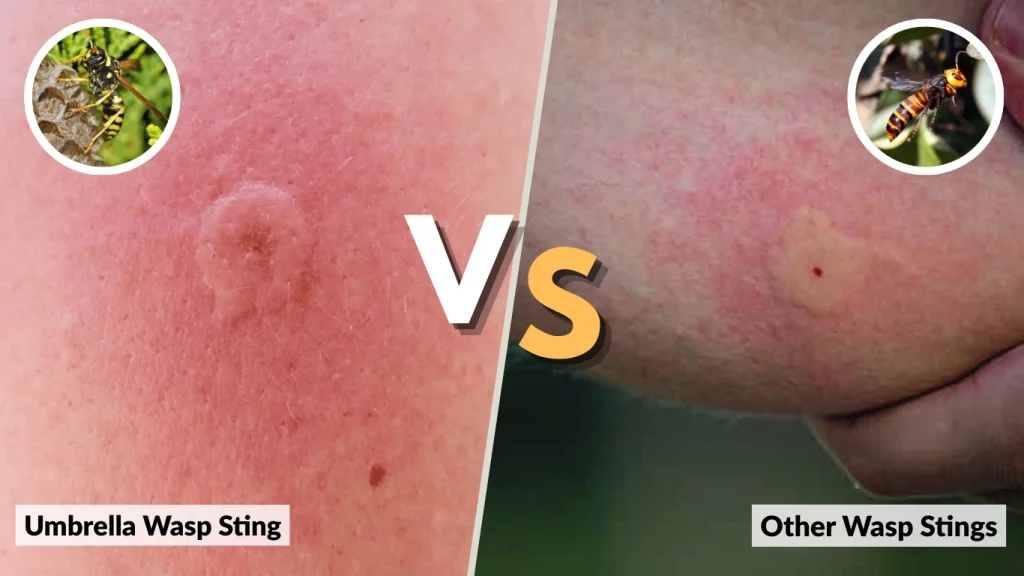 Umbrella Wasp Sting vs. Other Wasp Stings