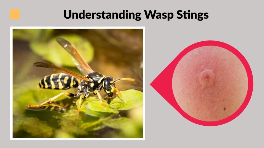 Understanding Wasp Stings