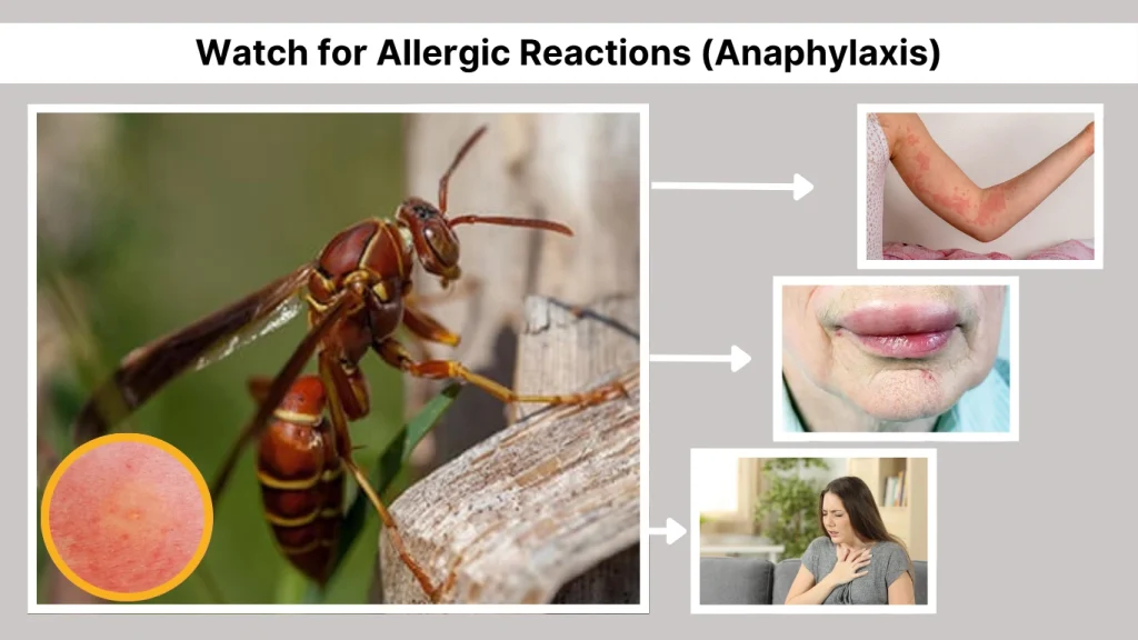 Watch for Allergic Reactions (Anaphylaxis)