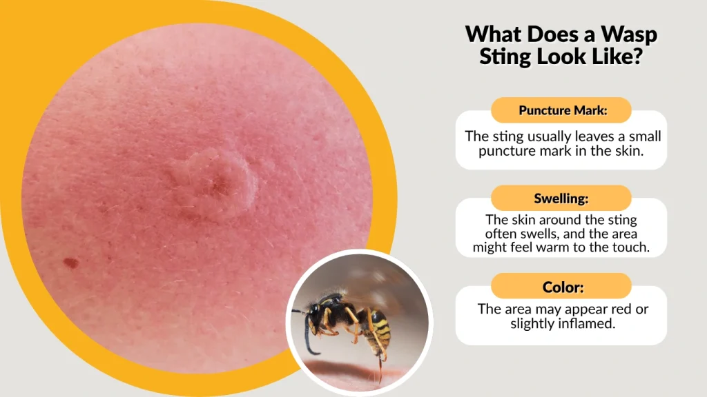 What Does a Wasp Sting Look Like