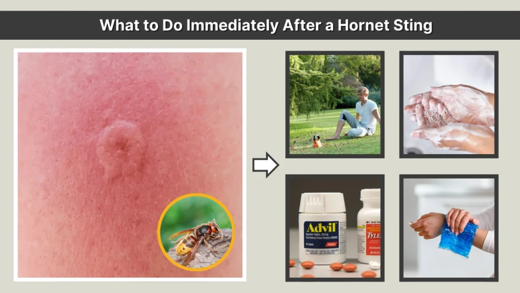 What to Do Immediately After a Hornet Sting