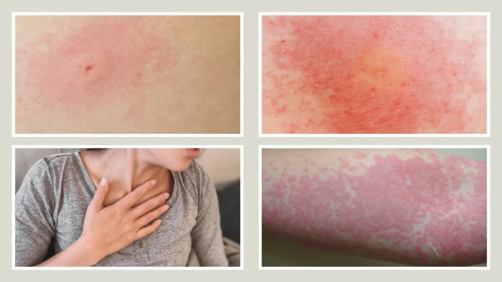 When to Seek Medical Attention