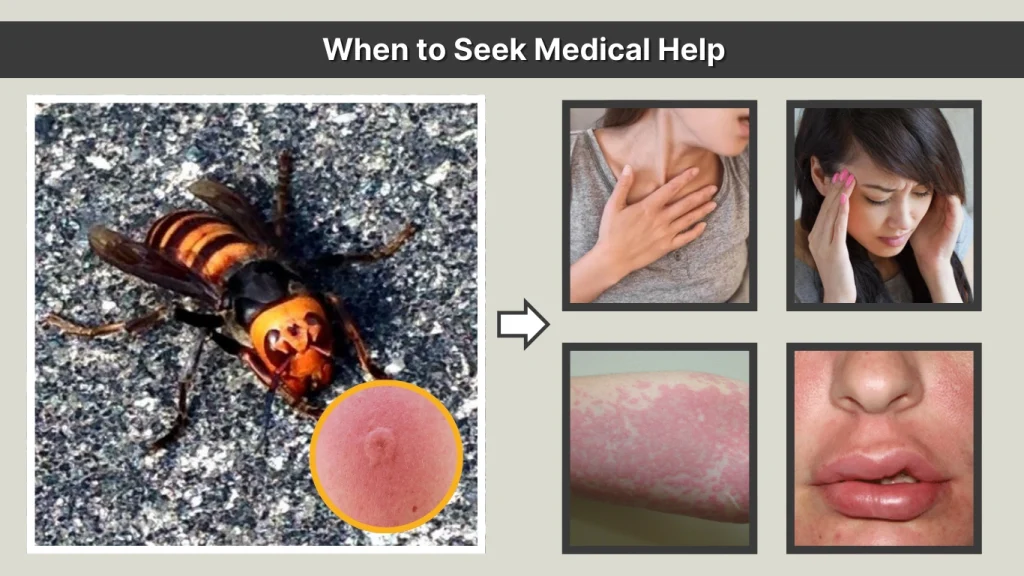 When to Seek Medical Help