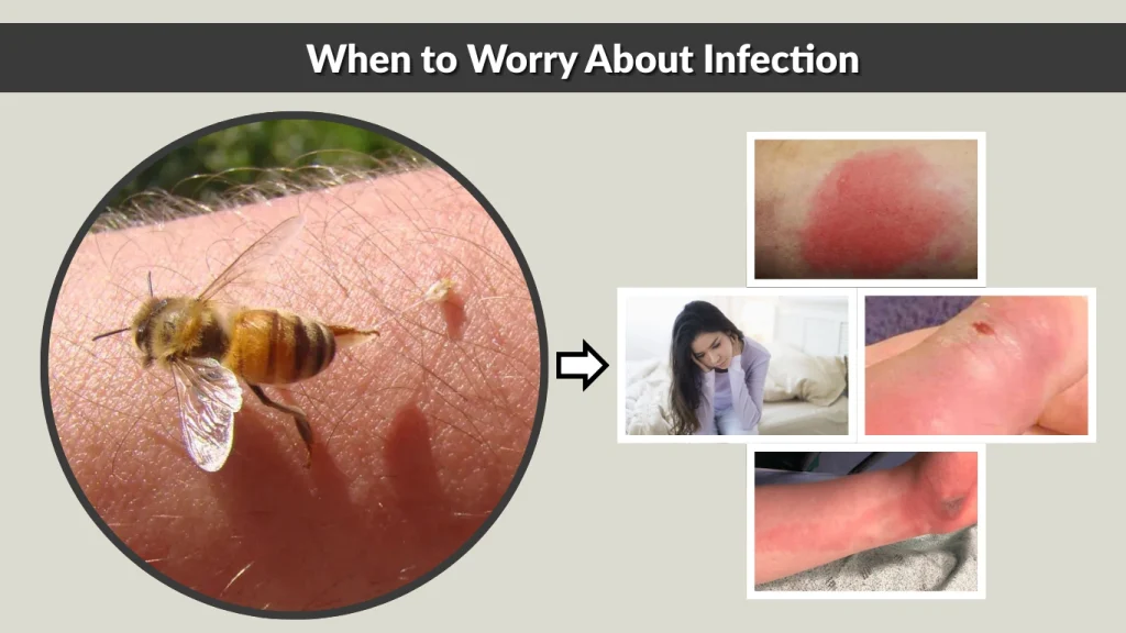 When to Worry About Infection