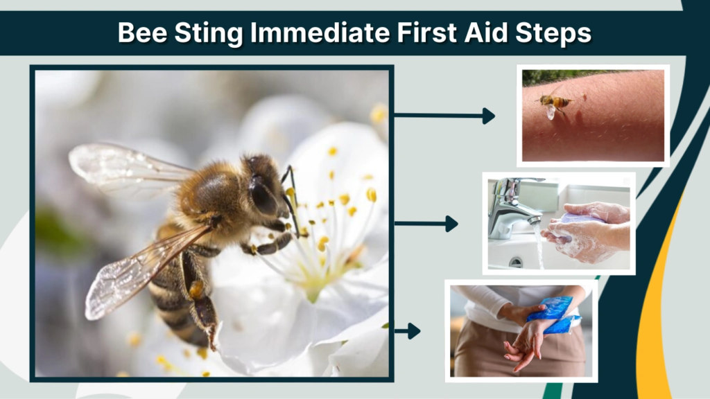 Bee Sting Immediate First Aid Steps