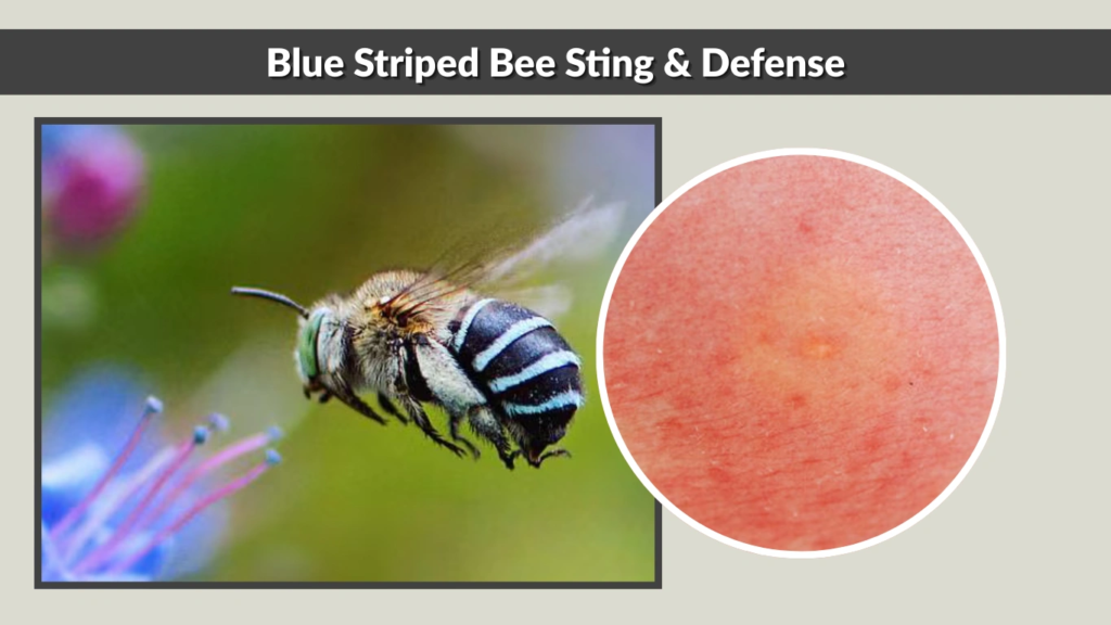 Blue Striped Bee Sting & Defense