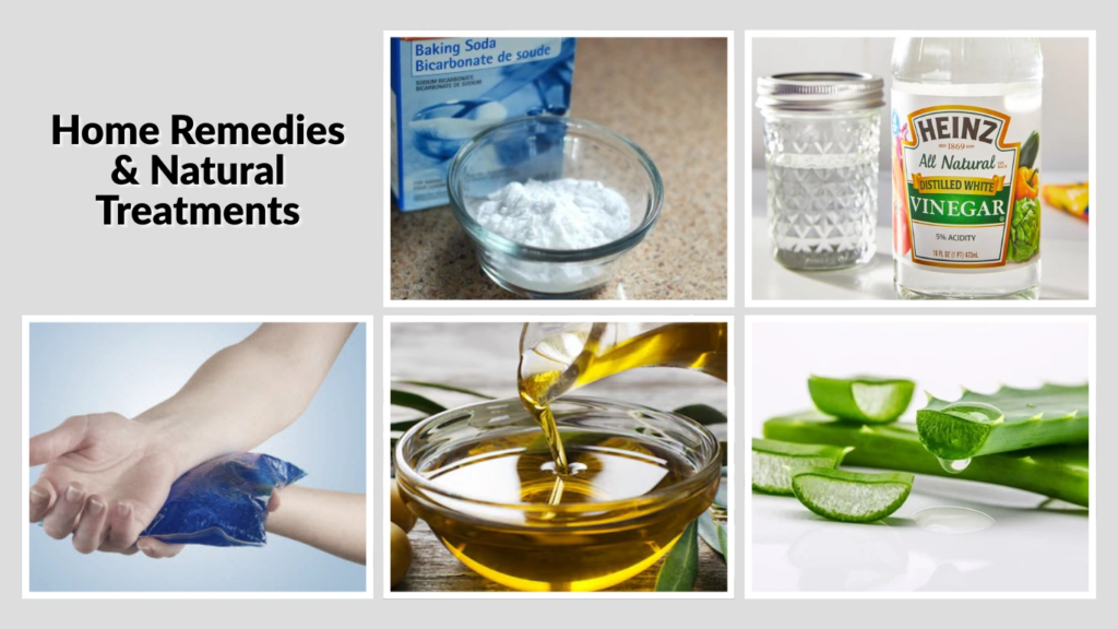 Home Remedies & Natural Treatments