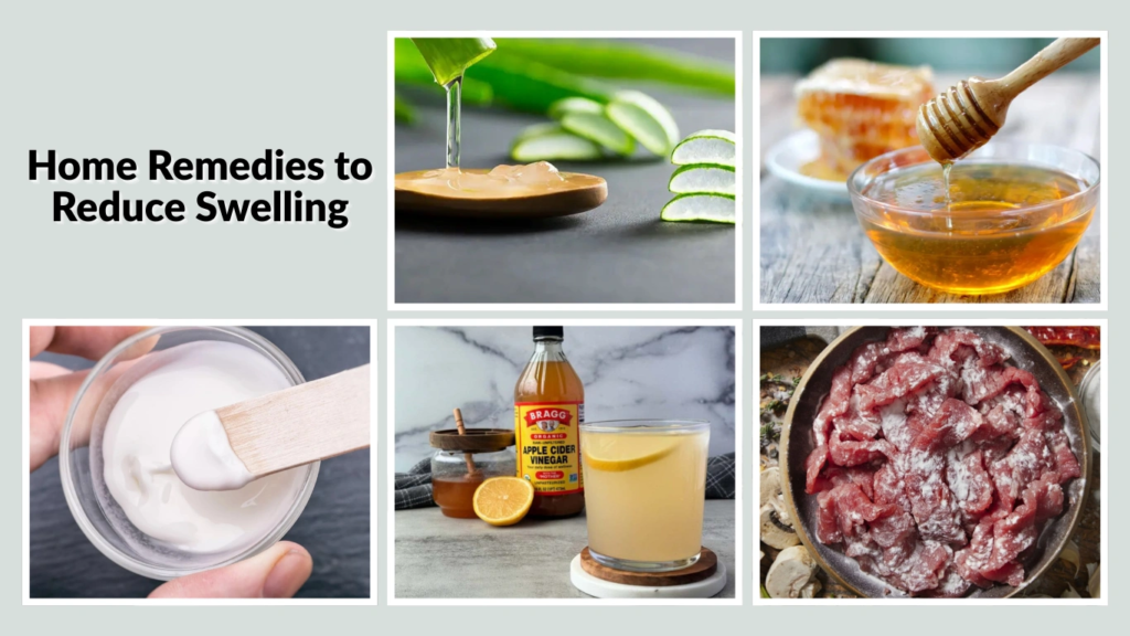 Home Remedies to Reduce Swelling