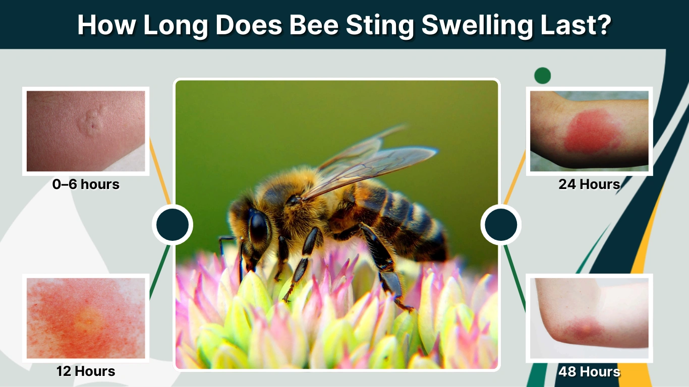 How Long Does Bee Sting Swelling Last