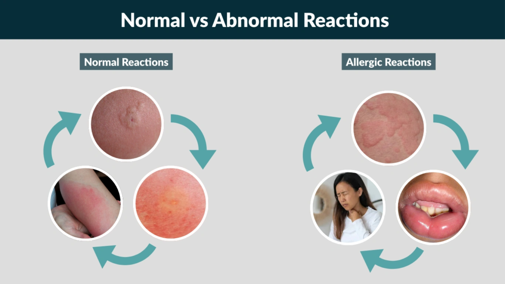 Normal vs Abnormal Reactions