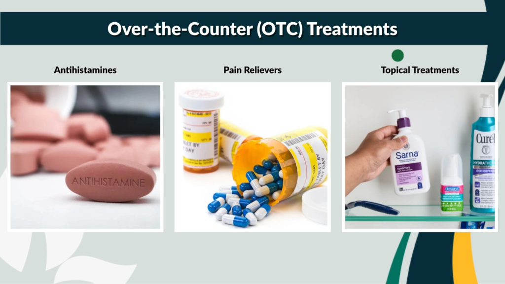 Over-the-Counter (OTC) Treatments