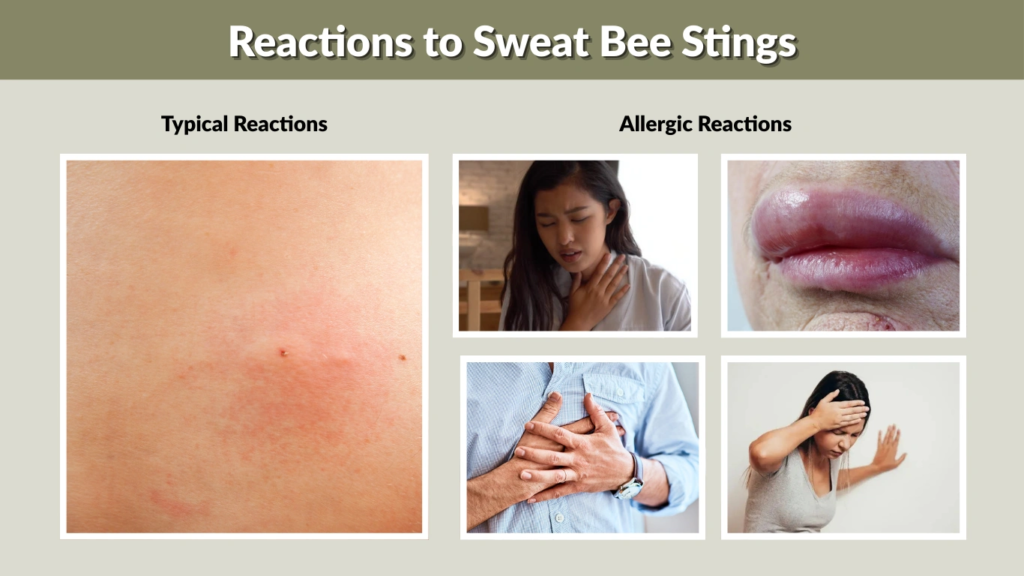 Reactions to Sweat Bee Stings