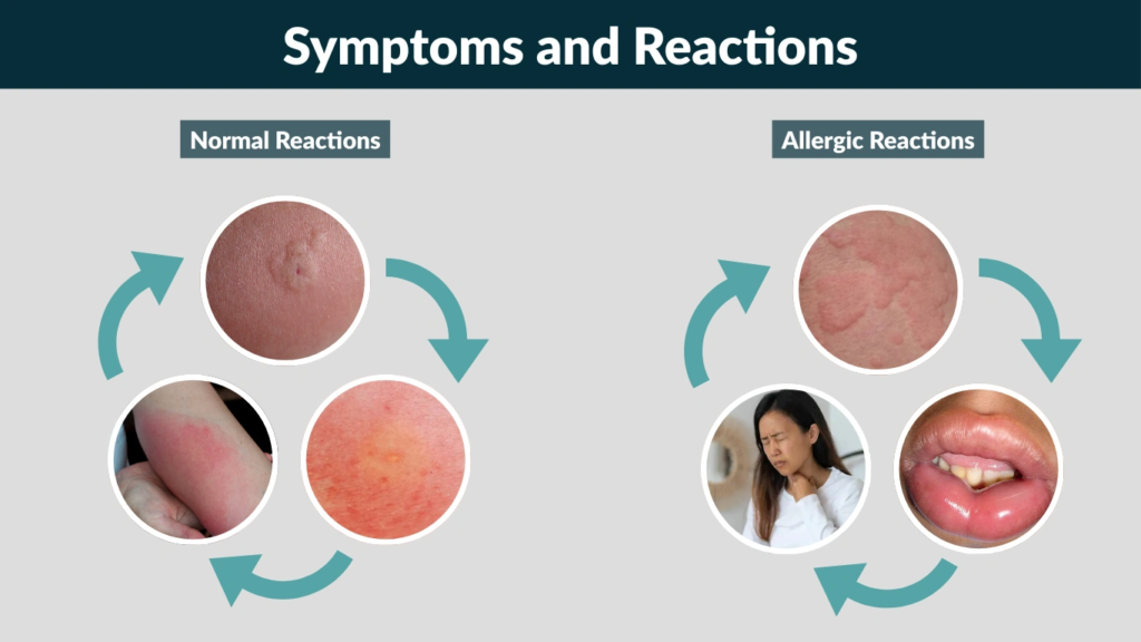 Symptoms and Reactions