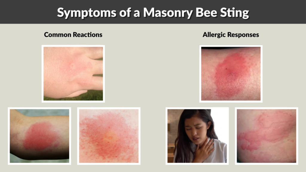 Symptoms of a Masonry Bee Sting