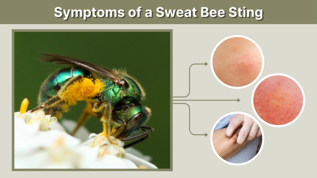 Symptoms of a Sweat Bee Sting