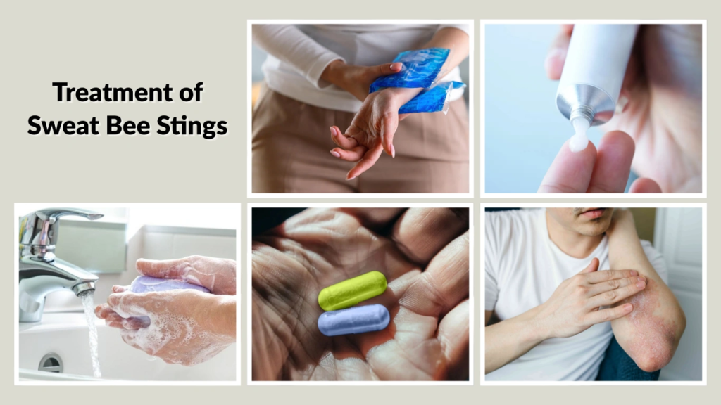 Treatment of Sweat Bee Stings